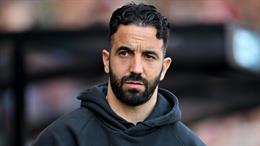 Ruben Amorim lên tiếng về kế hoạch xoay tua ở trận đấu Chelsea
